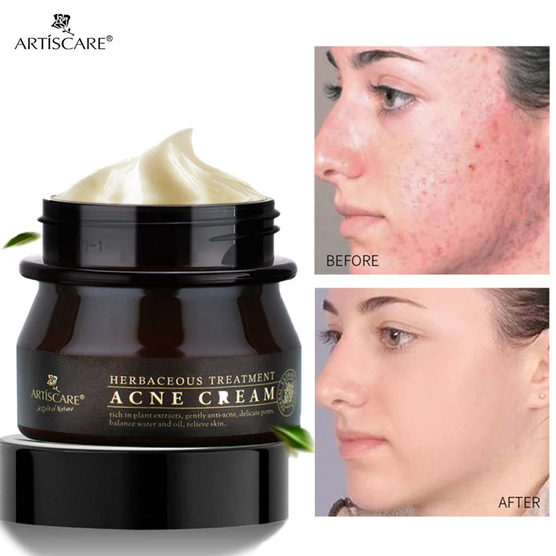 Herbal Acne Removal Face Cream Anti-Acne Gel Effective Treatment Acne Scar Black Dots Shrink Pores Whitening Face Beauty Care
Herbal Acne Removal Face Cream Anti-Acne Gel Effective Treatment Acne Scar Black Dots Shrink Pores Whitening Face Beauty Care