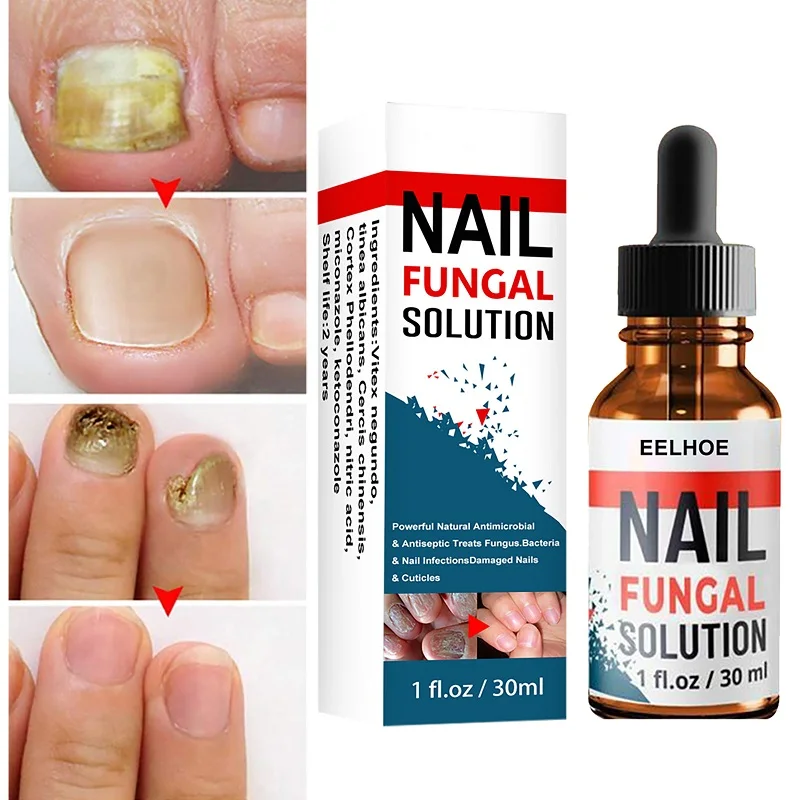 Toe Fungus Nails Repair Serum Anti Fungal Liquid Essence Anti Infection Remove Paronychia Onychomycosis Treatment Nails Care 30g
Toe Fungus Nails Repair Serum Anti Fungal Liquid Essence Anti Infection Remove Paronychia Onychomycosis Treatment Nails Care 30g
