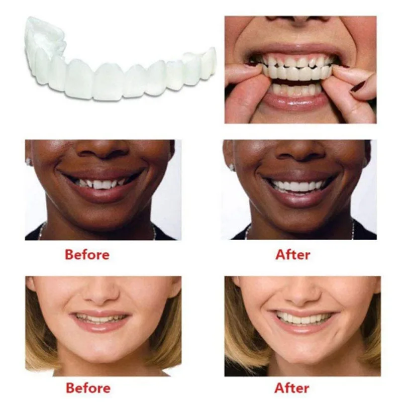 Denture Teeth Whitening Snap Bottom False Teeth Cover Veneers Fake Tooth Cover White Fit Snap On Silicone Beauty Cosmetic Teeth
Denture Teeth Whitening Snap Bottom False Teeth Cover Veneers Fake Tooth Cover White Fit Snap On Silicone Beauty Cosmetic Teeth