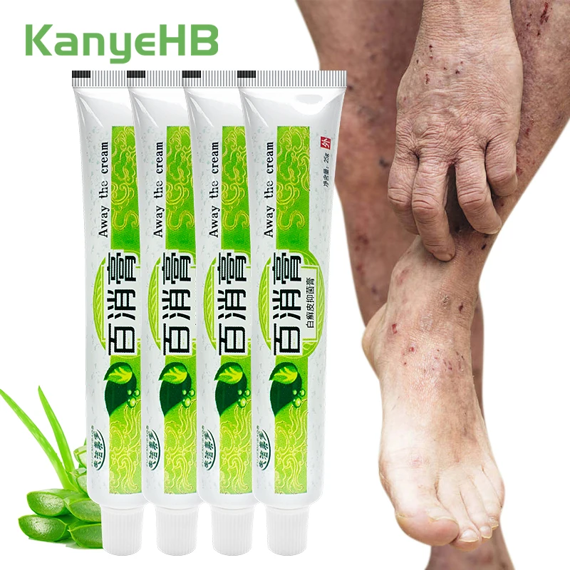 1-2-4pcs Psoriasis Ointment Inhibit Fungi Anti-inflammatory Eczema Cream Repair Damaged Skin Anti-itch Herbal Dermatitis Cream
1-2-4pcs Psoriasis Ointment Inhibit Fungi Anti-inflammatory Eczema Cream Repair Damaged Skin Anti-itch Herbal Dermatitis Cream