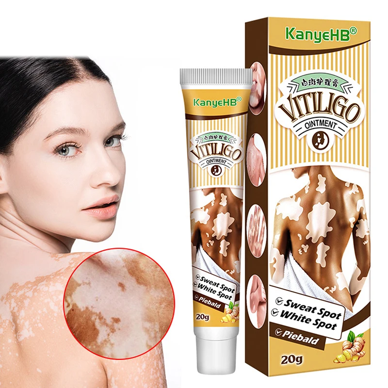 20g Vitiligo Leukoplakia Disease Treatments Ointment Melanin Repair Cream Disease White Spot Cream Pigment White Spot Repair
20g Vitiligo Leukoplakia Disease Treatments Ointment Melanin Repair Cream Disease White Spot Cream Pigment White Spot Repair