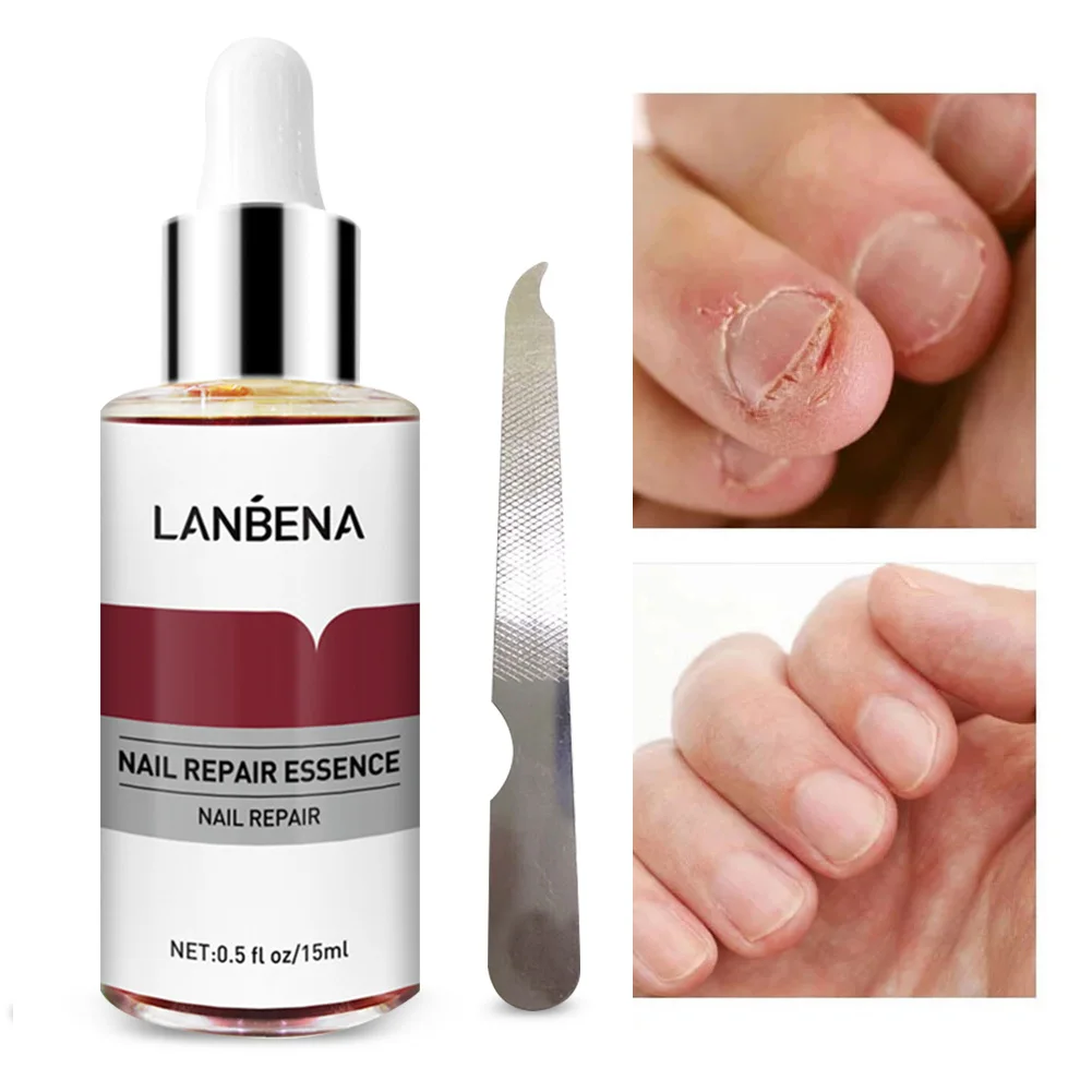 15ml Nail Fungus Treatment Serum Nail Repair Essence Onychomycosis Cracked Damaged Nails Repair for Fingernails Toenail Softener
15ml Nail Fungus Treatment Serum Nail Repair Essence Onychomycosis Cracked Damaged Nails Repair for Fingernails Toenail Softener