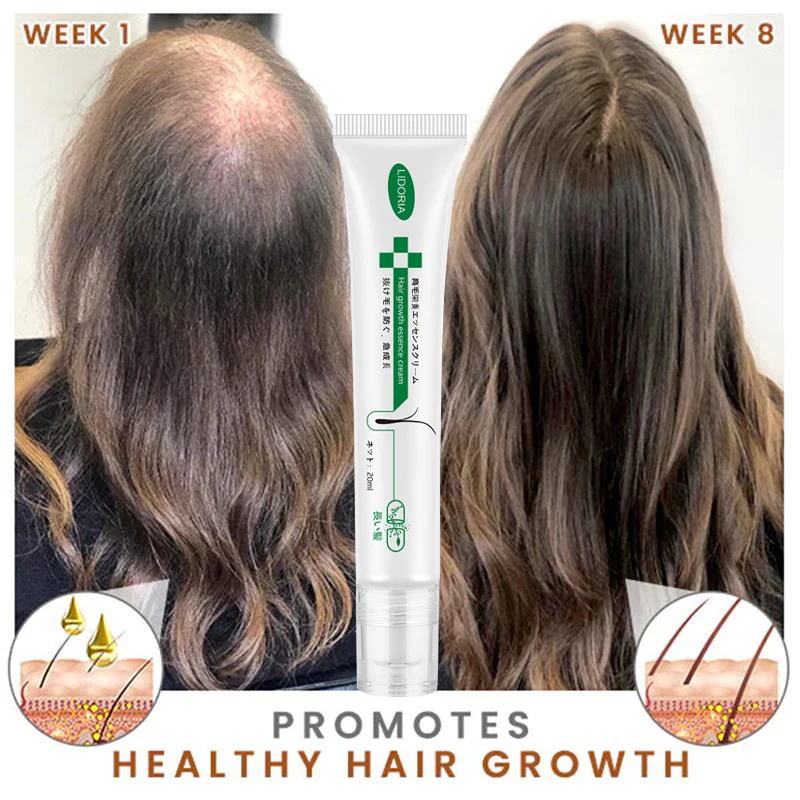 Ginger Hair Growth Product Men Women Massage Repair Anti Hair Loss Essential Oil Fast Growing Nourish Hair Root Beauty Hair Care
Ginger Hair Growth Product Men Women Massage Repair Anti Hair Loss Essential Oil Fast Growing Nourish Hair Root Beauty Hair Care