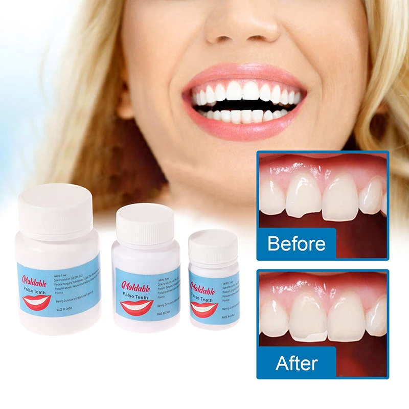 

5-30ml Dental Resin Shapeable Teeth Glue Makeup Dentures Modification Temporary Filling Teeth Repair Broken Teeth Tooth Gaps