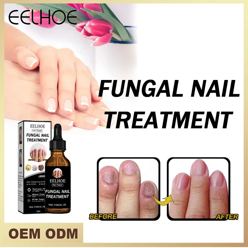 Makeup Grey nail repair liquid concave convex soft nail thickening grey nail repair liquid foot nail polish care liquid
Makeup Grey nail repair liquid concave convex soft nail thickening grey nail repair liquid foot nail polish care liquid