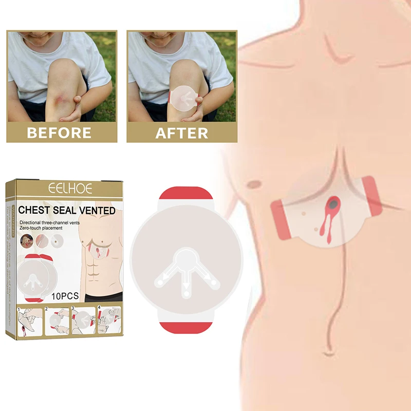 Наклейка медицинская для оказания первой помощи, 10 шт.
Наклейка медицинская для оказания первой помощи, 10 шт.