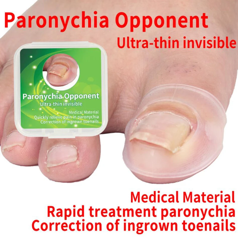 Useful Ultra-Thin Invisible Ingrown Toenails Correction Cover Pedicure Foot Toe Nail Care Corrector Paronychia Pain Supplies
Useful Ultra-Thin Invisible Ingrown Toenails Correction Cover Pedicure Foot Toe Nail Care Corrector Paronychia Pain Supplies