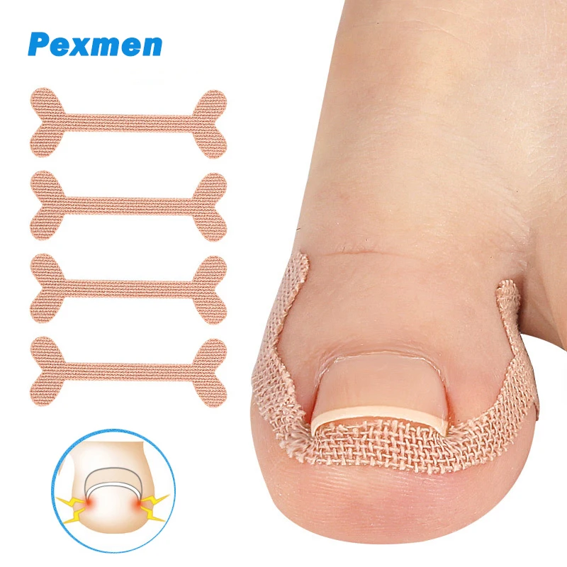 Pexmen 8Pcs/2Sheet Ingrown Toenail Correction Sticker Adhesive Toe Nail Patch Foot Care Pedicure Tool Pain Relief Nail Corrector
Pexmen 8Pcs/2Sheet Ingrown Toenail Correction Sticker Adhesive Toe Nail Patch Foot Care Pedicure Tool Pain Relief Nail Corrector