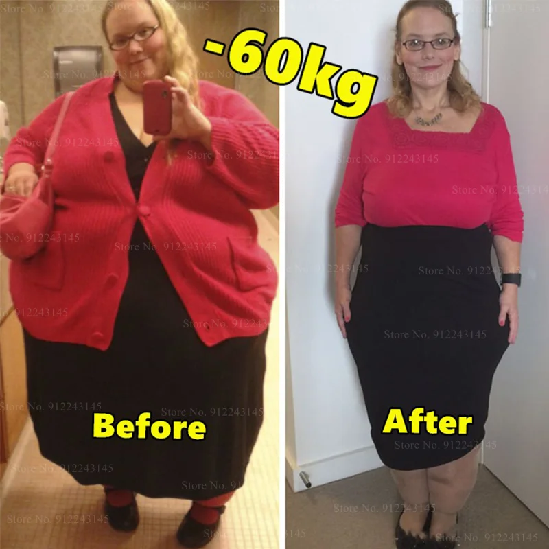 Lose Weight, Lose Weight, Burn Fat, Stubborn Postpartum Obesity, Lose Weight, Absorb Oil, Suppress Appetite and Satiety
Lose Weight, Lose Weight, Burn Fat, Stubborn Postpartum Obesity, Lose Weight, Absorb Oil, Suppress Appetite and Satiety