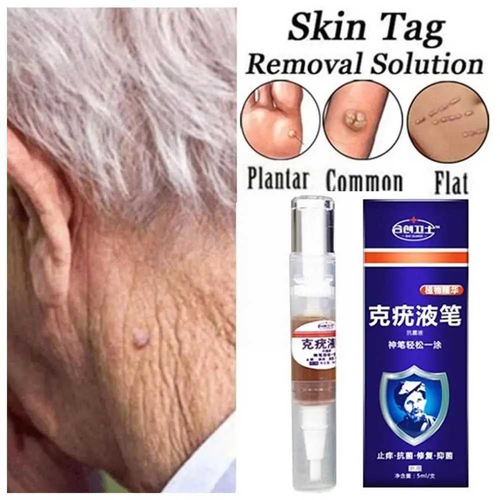 Ultra Strength Skin Tag Remover Liquid Pen Foot Corn Remover 12hours Medical Tag Useful Tu Mole Genital 5ml Skin Kill Wart F3r2
Ultra Strength Skin Tag Remover Liquid Pen Foot Corn Remover 12hours Medical Tag Useful Tu Mole Genital 5ml Skin Kill Wart F3r2