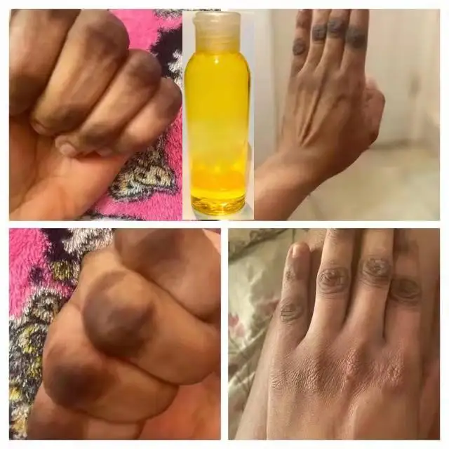 Organic Effective Yellow Peeling Oil, Exfoliating Dead Skin Remover Reduce Dryness Roughness Hand Foot Knuckle Repair Care Serum
Organic Effective Yellow Peeling Oil, Exfoliating Dead Skin Remover Reduce Dryness Roughness Hand Foot Knuckle Repair Care Serum