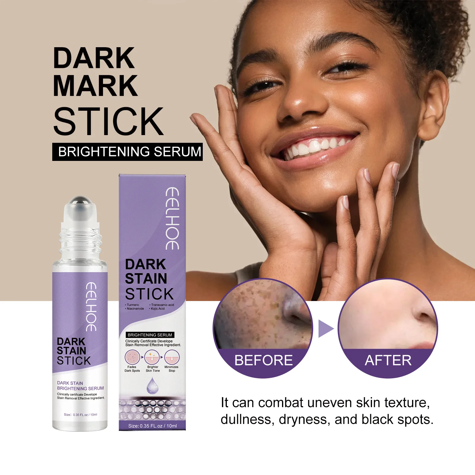 Для отбеливания веснушек ролик для крема для удаления темных пятен мелазма осветляет рубцы от акне, пигментация меланина, осветляет уход за кожей
Для отбеливания веснушек ролик для крема для удаления темных пятен мелазма осветляет рубцы от акне, пигментация меланина, осветляет уход за кожей