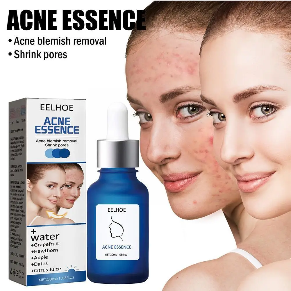 Lactobionic Acid Pore Shrink Face Serum Hyaluronic Bright Acid Moisturizing Facial Skin Corrector Scar Improve Essence Acne J4C8
Lactobionic Acid Pore Shrink Face Serum Hyaluronic Bright Acid Moisturizing Facial Skin Corrector Scar Improve Essence Acne J4C8