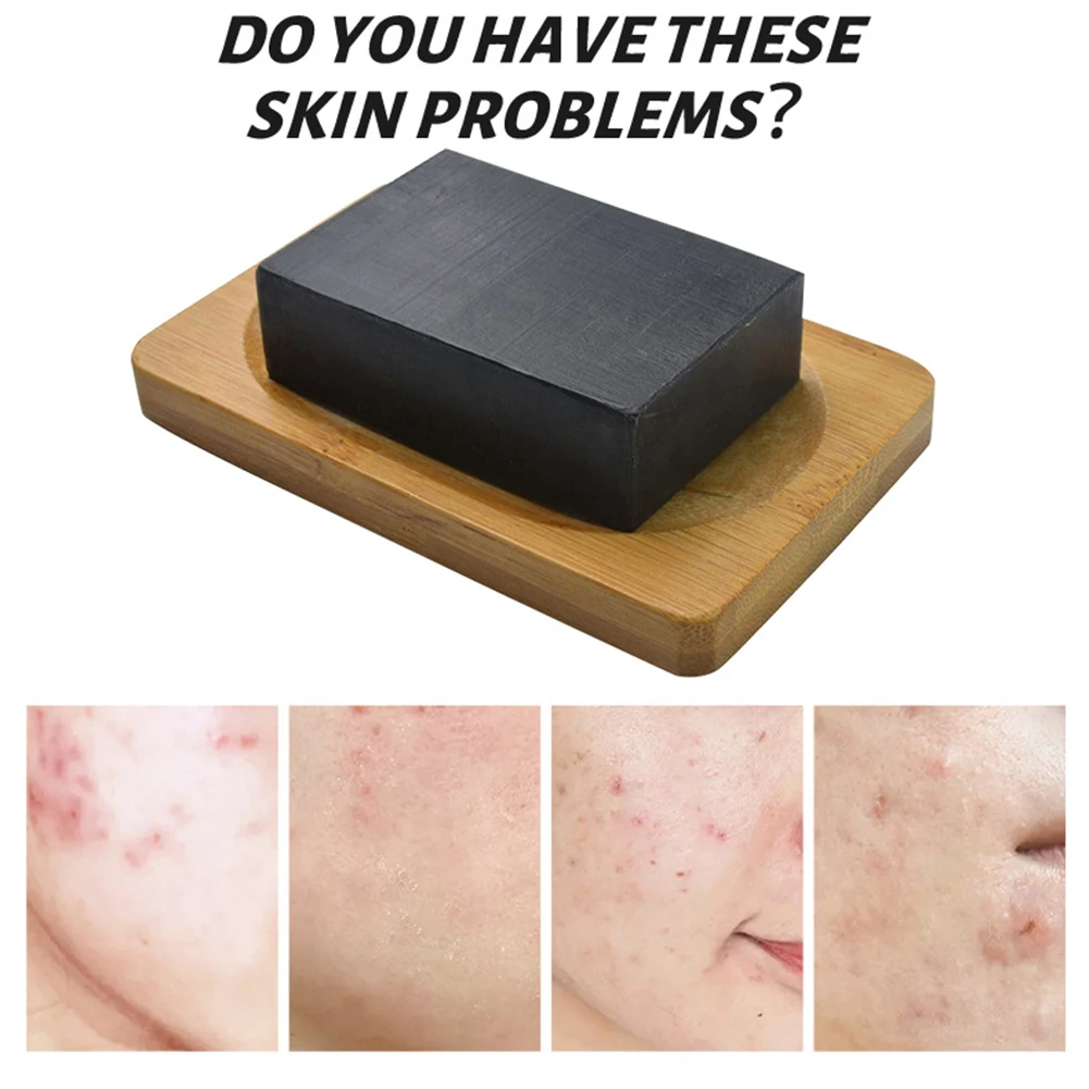 120g Organic Whitening Soap Antibacterial Body Cleansing Soap Remove Blackheads Natural Cleansing Soap Vitamin E Skin Care
120g Organic Whitening Soap Antibacterial Body Cleansing Soap Remove Blackheads Natural Cleansing Soap Vitamin E Skin Care