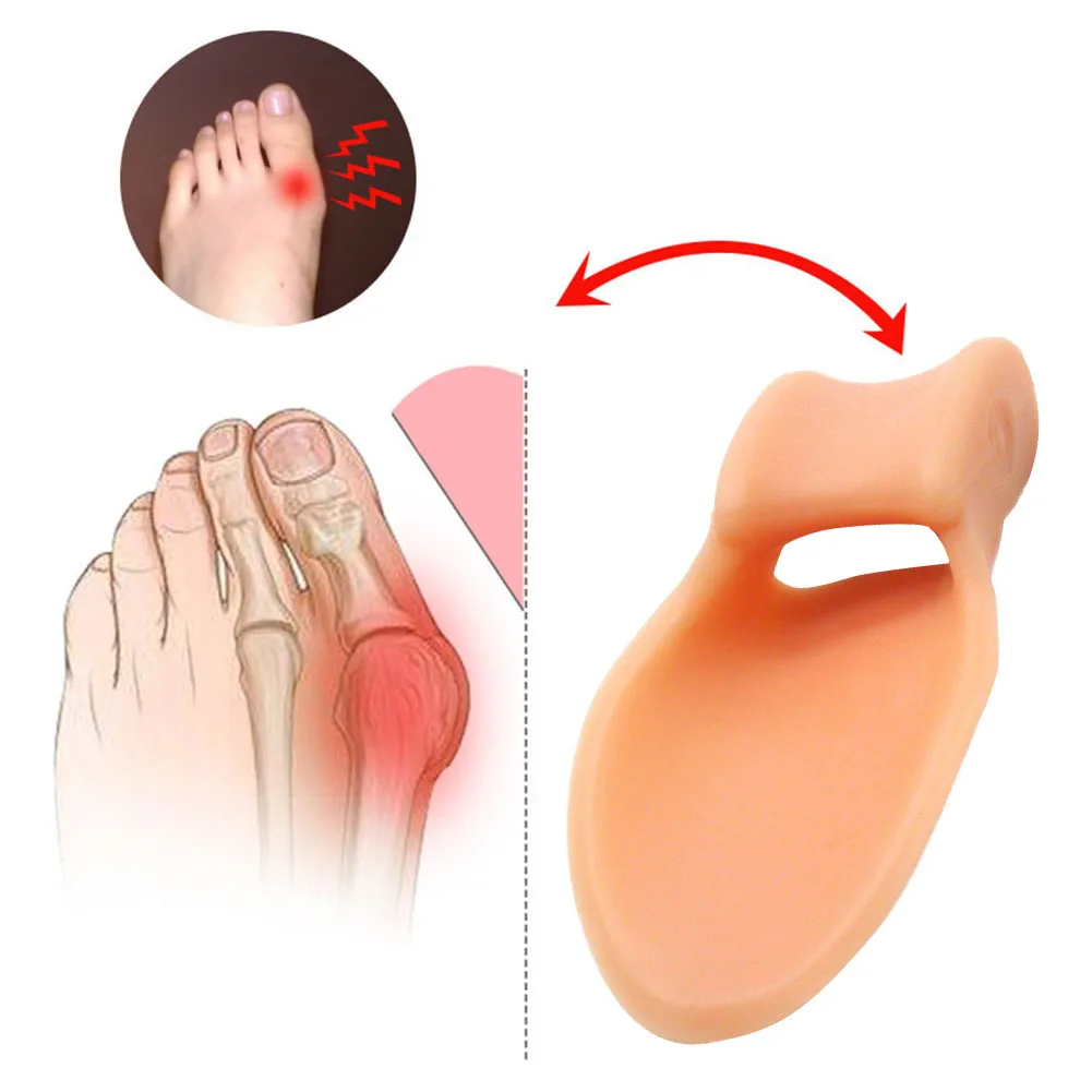 UPAKME 2pcs Silicone Gel Big Toe Separators Bunion Bone Ectropion Toes Corrector Separator Hallux Valgus Finger Straightener New
UPAKME 2pcs Silicone Gel Big Toe Separators Bunion Bone Ectropion Toes Corrector Separator Hallux Valgus Finger Straightener New