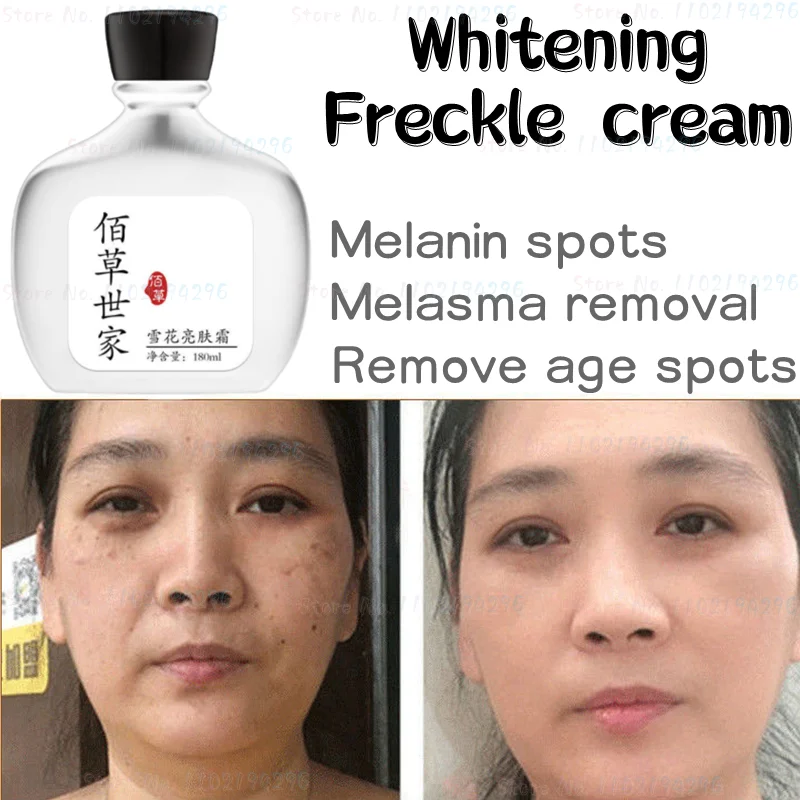 Whitening and Freckle Cream, Melanin, Light Spots, Macular, Brown Spots, Age Spots, Freckles, Freckles, Unisex Skin Whitening
Whitening and Freckle Cream, Melanin, Light Spots, Macular, Brown Spots, Age Spots, Freckles, Freckles, Unisex Skin Whitening