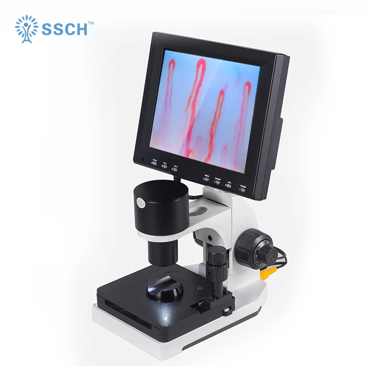 high definition magnifier Blood Capillary nailfold capillaroscopy microcirculation detector
high definition magnifier Blood Capillary nailfold capillaroscopy microcirculation detector