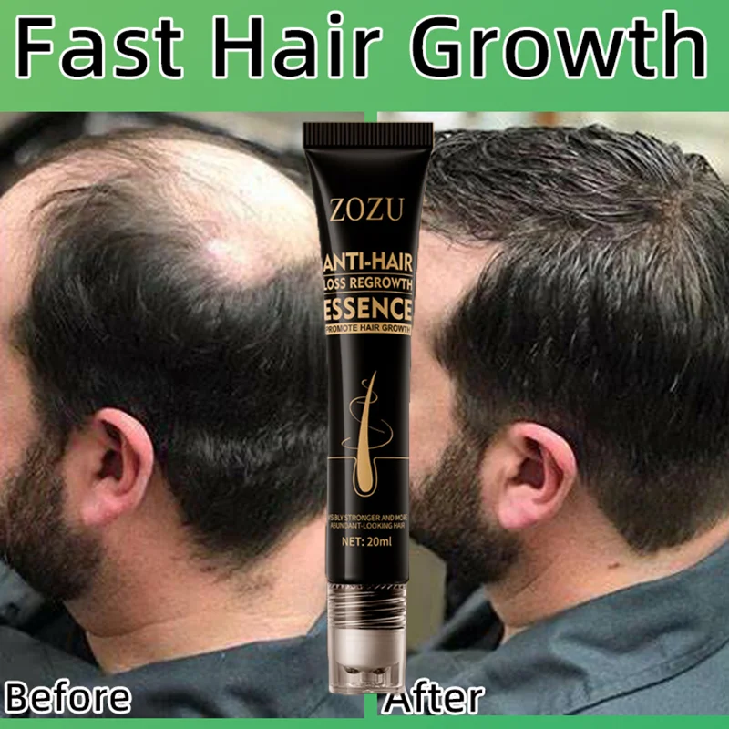 Hair Growth Serum Products Fast Regrowth Anti Hair Loss Prevent Dry Frizzy Damaged Repair Scalp Massage Essence Beauty Hair Care
Hair Growth Serum Products Fast Regrowth Anti Hair Loss Prevent Dry Frizzy Damaged Repair Scalp Massage Essence Beauty Hair Care