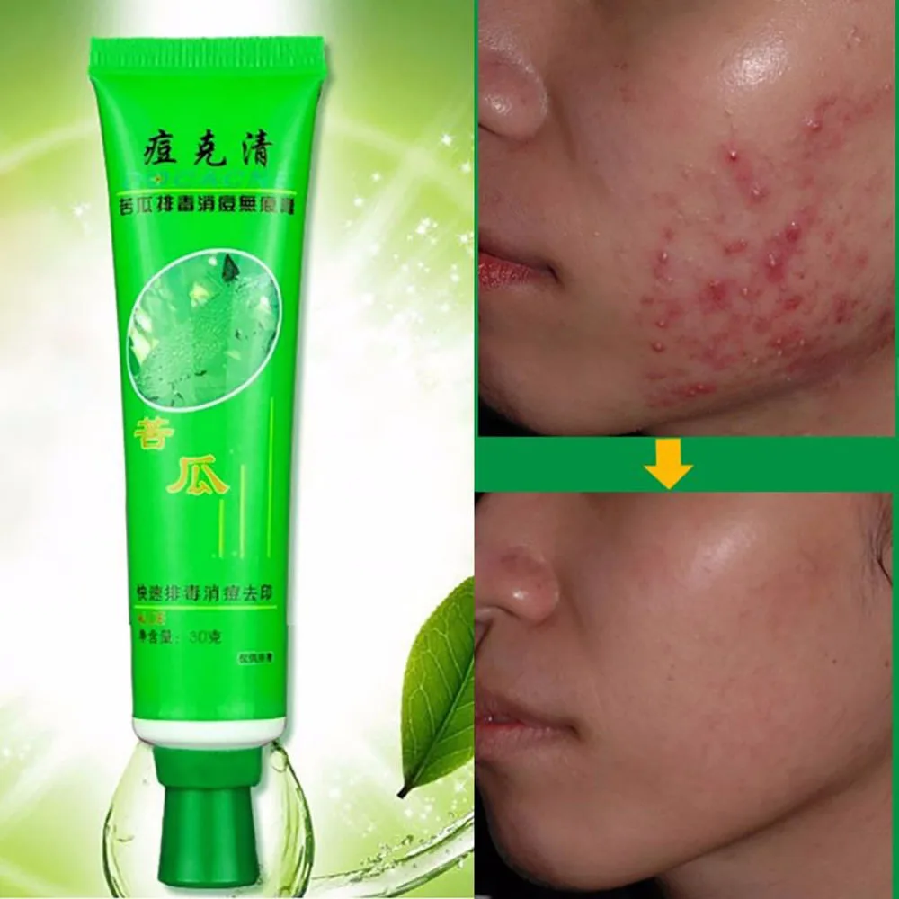 Momordica Charantia Acne Face Cream Bitter Gourd Acne Light Mark Gel Repair Facial Skin Oil Control Acne Skin Care Facial Cream
Momordica Charantia Acne Face Cream Bitter Gourd Acne Light Mark Gel Repair Facial Skin Oil Control Acne Skin Care Facial Cream
