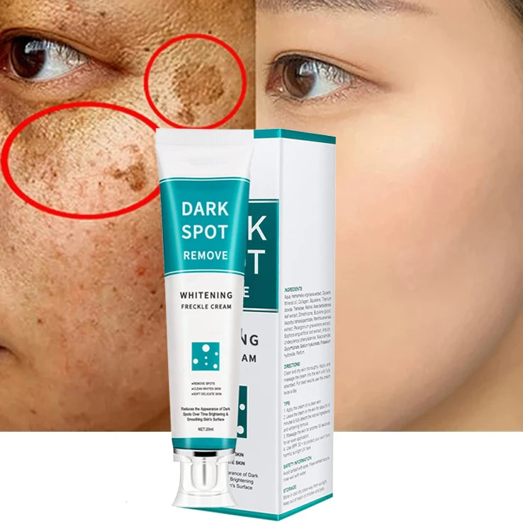 Effective Whitening Freckle Cream Fade Dark Spots Remove Melanin Melasma Pigmentation Lightening Brighten Moisturizing Skin Care
Effective Whitening Freckle Cream Fade Dark Spots Remove Melanin Melasma Pigmentation Lightening Brighten Moisturizing Skin Care