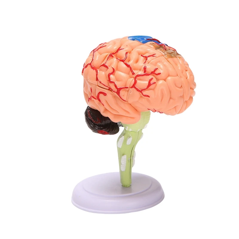 4D Assembled Human Anatomical Model Brain Model, Brain Structure Model, Student Teaching and Explanation Model
4D Assembled Human Anatomical Model Brain Model, Brain Structure Model, Student Teaching and Explanation Model