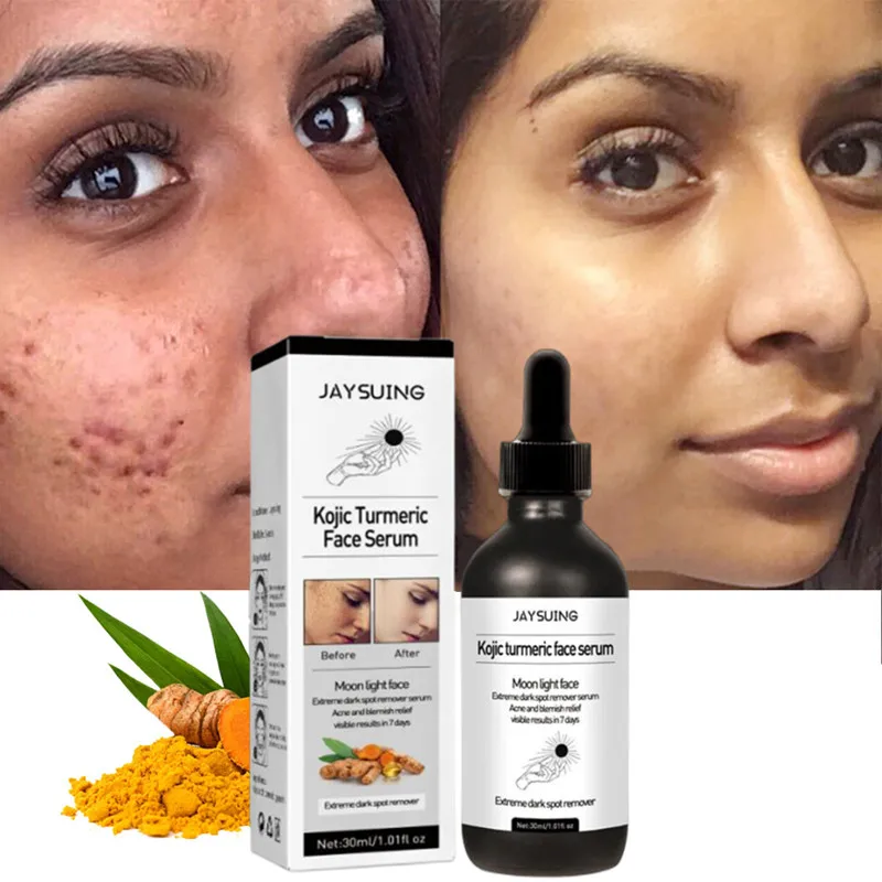 Turmeric Skin Whitening Cream for Dark Skin Acne Treatment Lighten Dark Spots Moisturizing Brightening Cream for Face Skin Care
Turmeric Skin Whitening Cream for Dark Skin Acne Treatment Lighten Dark Spots Moisturizing Brightening Cream for Face Skin Care