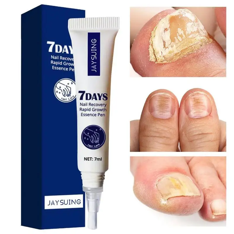 Масло для роста ногтей, клей для ремонта ногтей, многофункциональное масло для ногтей 7 мл, интенсивный кондиционер для роста ногтей для обесцвеченных треснувших поврежденных ногтей
Масло для роста ногтей, клей для ремонта ногтей, многофункциональное масло для ногтей 7 мл, интенсивный кондиционер для роста ногтей для обесцвеченных треснувших поврежденных ногтей