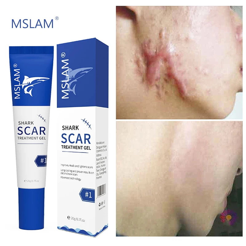 Herbal Scar Removal Cream Treatment Stretch Marks Burn Acne Surgical Scar Repair Gel Smoothing Whitening Beauty Health Skin Care
Herbal Scar Removal Cream Treatment Stretch Marks Burn Acne Surgical Scar Repair Gel Smoothing Whitening Beauty Health Skin Care