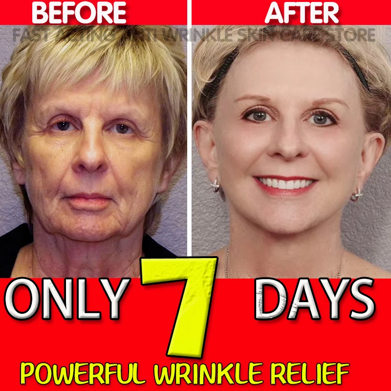 Retinol Wrinkle Remover Face Serum Anti-Aging Fade Fine Line Lifting Firming Moisturizing Essence Whitening Brighten Repair Skin
Retinol Wrinkle Remover Face Serum Anti-Aging Fade Fine Line Lifting Firming Moisturizing Essence Whitening Brighten Repair Skin