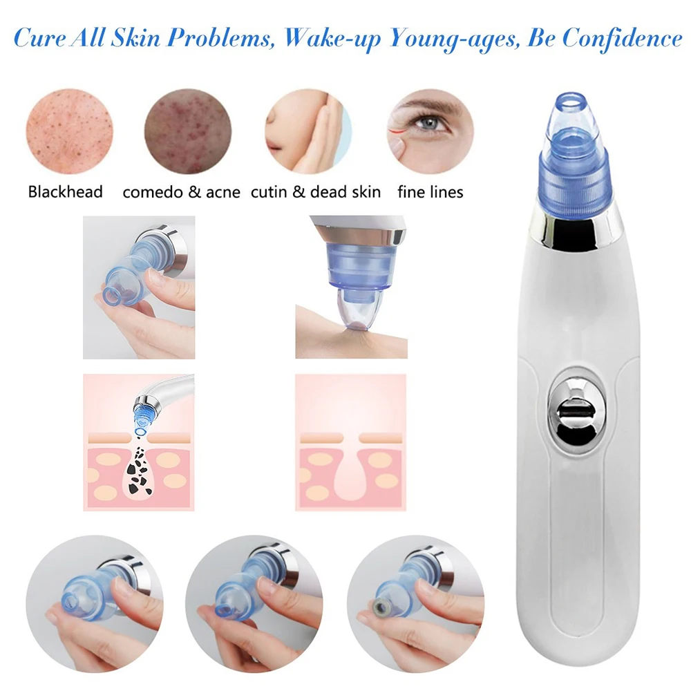 

HOT！ Vacuum Pore Cleaner Blackhead Remover Electric Acne Clean Exfoliating Cleansing Comedo Suction Facial Beauty Machine