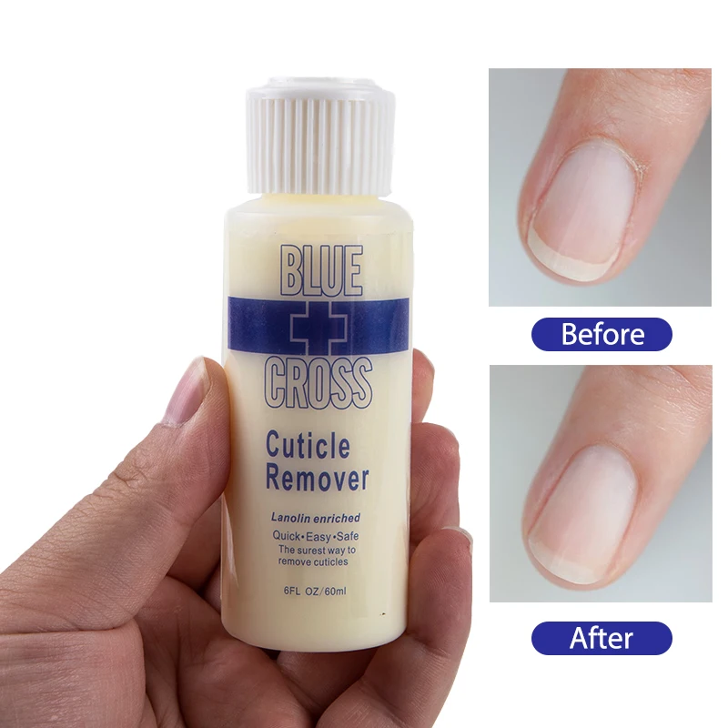 60 мл, смягчитель, Подошвенный кутин, удаление омертвевшей кожи, мозолей, пленка для пятки, сухое смягчение трещин, смягчитель ногтей и ног, ...
60 мл, смягчитель, Подошвенный кутин, удаление омертвевшей кожи, мозолей, пленка для пятки, сухое смягчение трещин, смягчитель ногтей и ног, ...