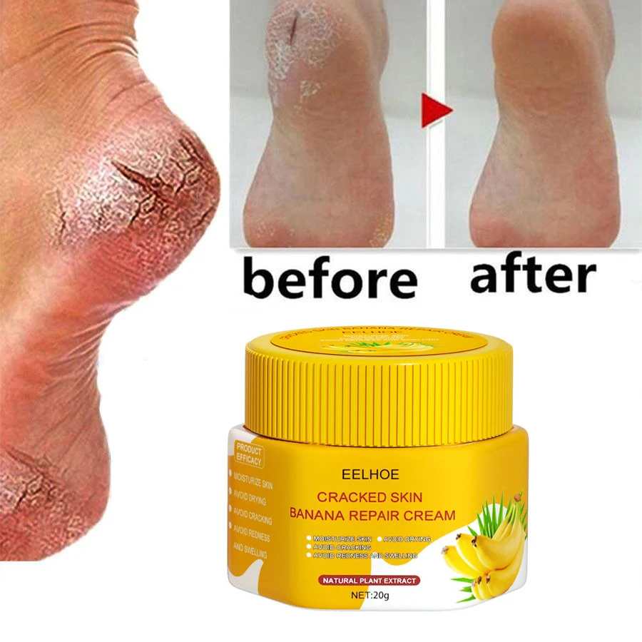 Anti-Drying Crack Foot Cream Heel Cracked Repair Banana Oil Anti Infection Removal Dead Moisturizing Smooth Hand Feet Skin Care
Anti-Drying Crack Foot Cream Heel Cracked Repair Banana Oil Anti Infection Removal Dead Moisturizing Smooth Hand Feet Skin Care