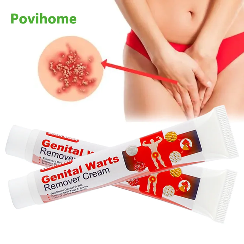 20g Against Genital Wart Cream Vulva Human Papillomavirus Mole Remove Plaster Foot Corn Warts Removes Moles Skin Tag Ointment
20g Against Genital Wart Cream Vulva Human Papillomavirus Mole Remove Plaster Foot Corn Warts Removes Moles Skin Tag Ointment