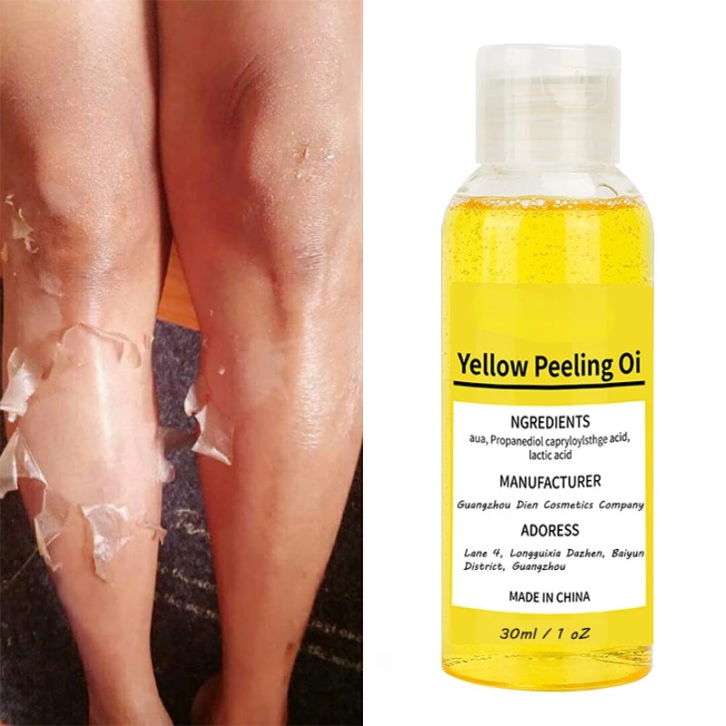 Thaise Geel Peeling Olie Bleken Donkere Huid Retinol Met Peptide Vlekken Mee-eters Vlekken Slechte Huid Spot Behandeling
Thaise Geel Peeling Olie Bleken Donkere Huid Retinol Met Peptide Vlekken Mee-eters Vlekken Slechte Huid Spot Behandeling