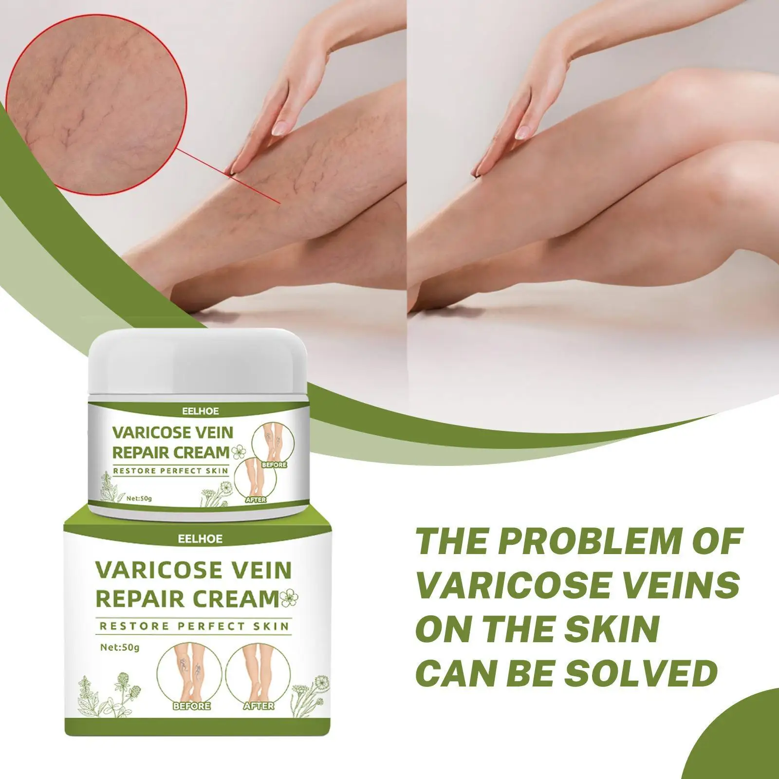 Varicose Vein Repair Cream Leg Swelling Care Cream Soothing Pain Phlebitis Improves Blood Circulation Herbal Body Care
Varicose Vein Repair Cream Leg Swelling Care Cream Soothing Pain Phlebitis Improves Blood Circulation Herbal Body Care
