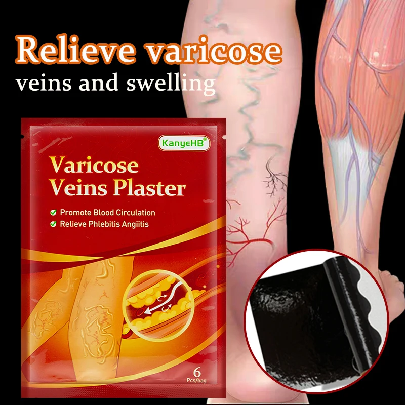 Varicose Veins Patch Natural Herbal Spider Veins Vasculitis Vein Patch Leg Pain Relief Phlebitis Vein Edema Angiitis Foot Care
Varicose Veins Patch Natural Herbal Spider Veins Vasculitis Vein Patch Leg Pain Relief Phlebitis Vein Edema Angiitis Foot Care