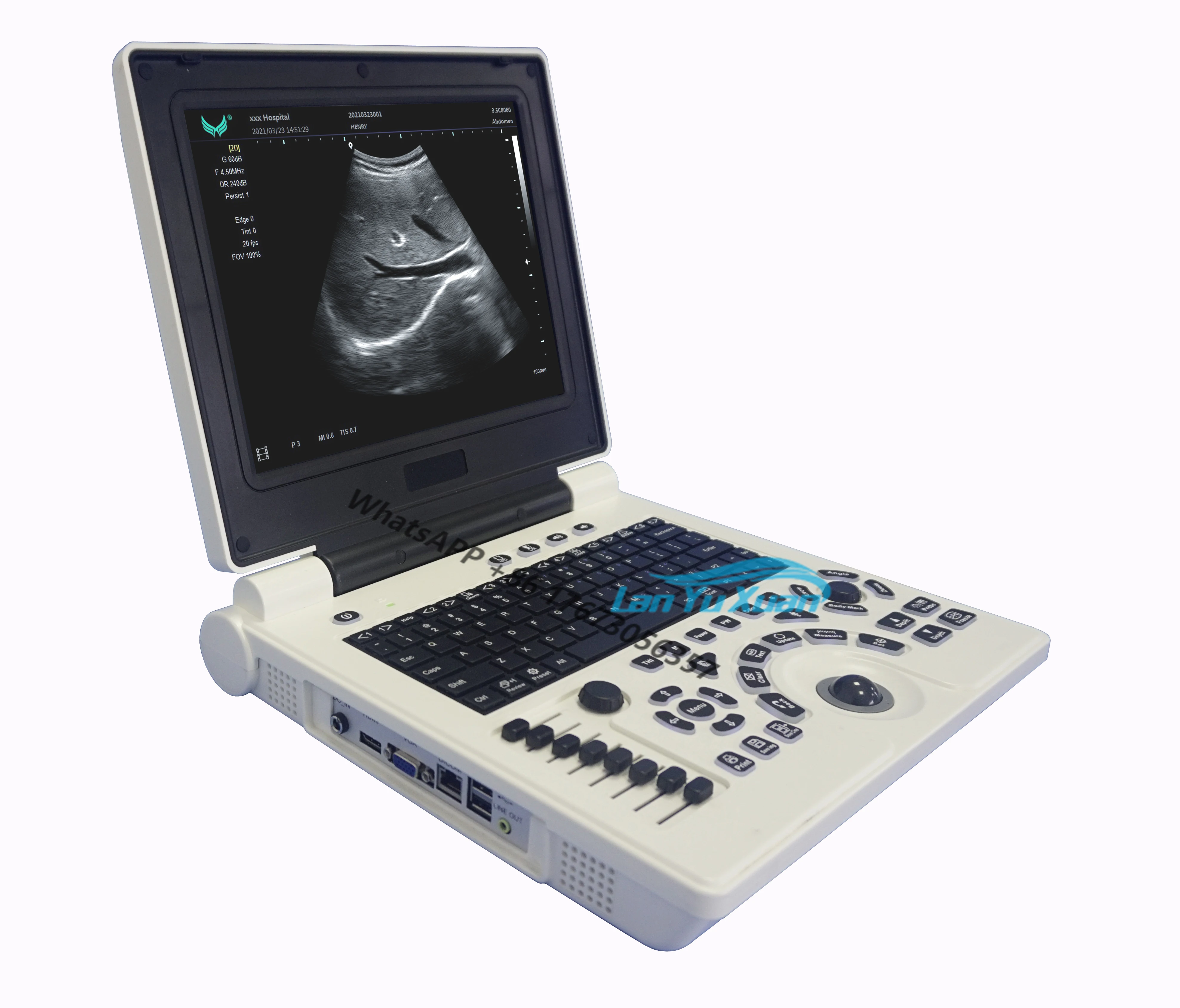 

Cheap BW Ultrasound Scanner with THI PW 3D for Human or Veterinary Software Optional