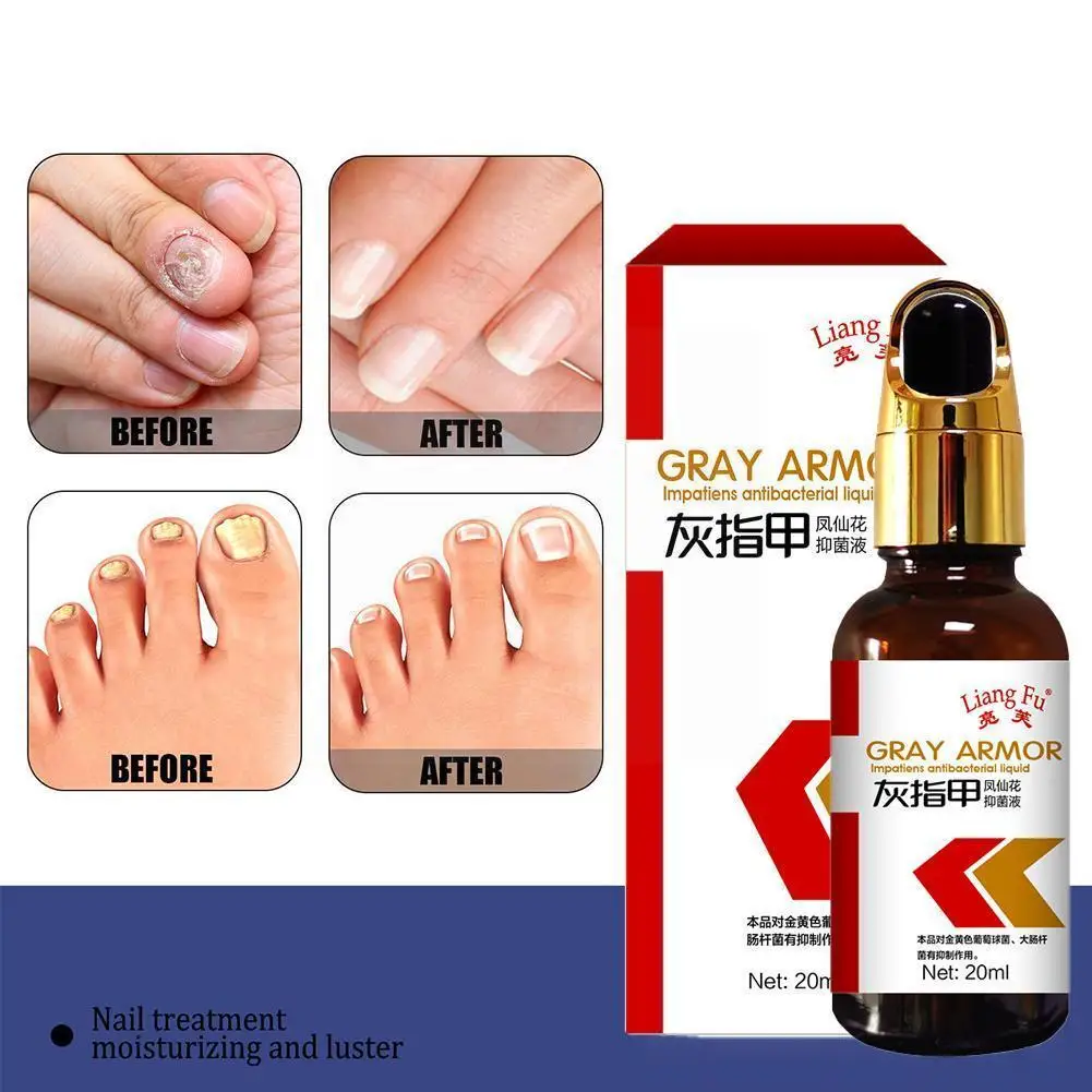 20ml Nail Repair Essence Serum Treat Foot Nail Fungus Foot Care Infection Removal Nail Gel Anti P9y3
20ml Nail Repair Essence Serum Treat Foot Nail Fungus Foot Care Infection Removal Nail Gel Anti P9y3