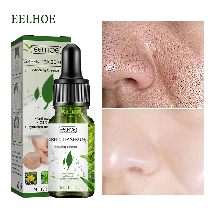 Improve Acne Blackheads Dry Whitening Remove Dark Spots Green Tea Oil Control Pore Shrink Face Serum Skin Care Korean Cosmetics
Improve Acne Blackheads Dry Whitening Remove Dark Spots Green Tea Oil Control Pore Shrink Face Serum Skin Care Korean Cosmetics