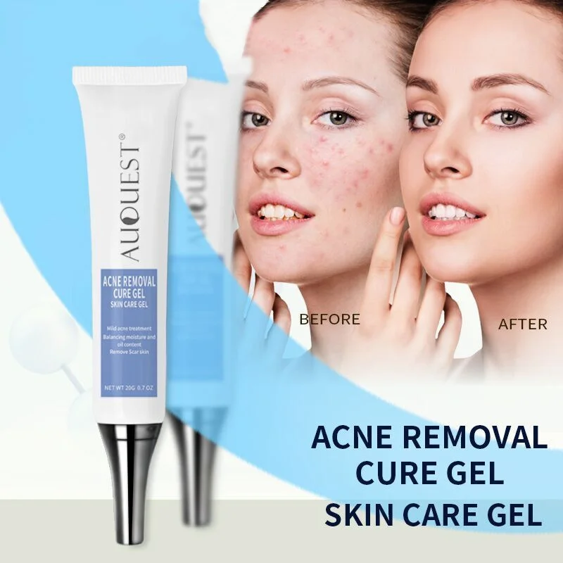 Herbal Acne Treatment Cream Pimple Spot Removal for Teens Oil Control Acne Scar Gel Shrink Pores Skin Care Beauty Health Product
Herbal Acne Treatment Cream Pimple Spot Removal for Teens Oil Control Acne Scar Gel Shrink Pores Skin Care Beauty Health Product
