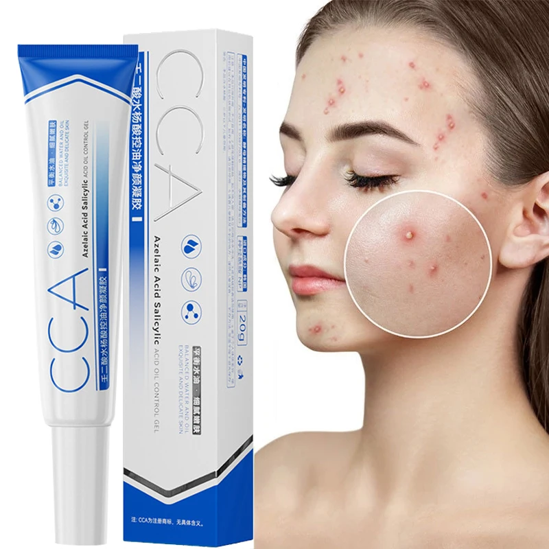 Effective Acne Removal Herb Gel Treatment Acne Scar Shrink Pores Oil Control Whitening Moisturize Salicylic Acid Skin Care 20g
Effective Acne Removal Herb Gel Treatment Acne Scar Shrink Pores Oil Control Whitening Moisturize Salicylic Acid Skin Care 20g