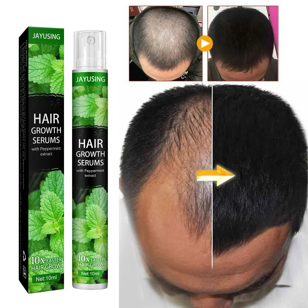 4/1pcs Herbal Essence Hair Growth Spray Serum Anti Hair Loss Products Fast Grow Prevent Hair Dry Damaged Thinning Repair Care
4/1pcs Herbal Essence Hair Growth Spray Serum Anti Hair Loss Products Fast Grow Prevent Hair Dry Damaged Thinning Repair Care