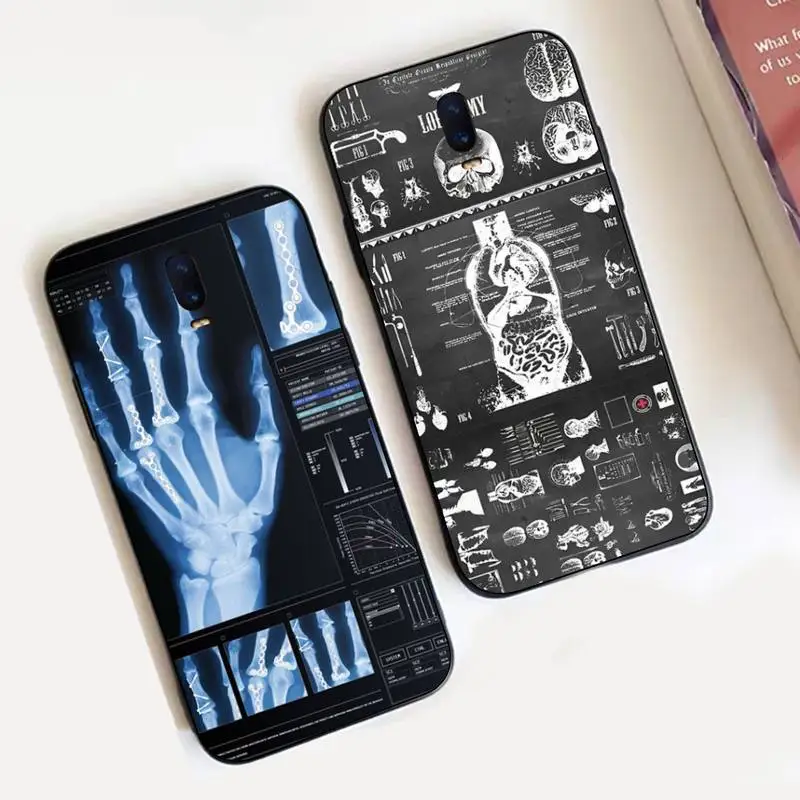 Radiological Human Organs Skeleton Skull Phone Case for Vivo Y91C Y11 17 19 17 67 81 Oppo A9 2020 Realme c3
Radiological Human Organs Skeleton Skull Phone Case for Vivo Y91C Y11 17 19 17 67 81 Oppo A9 2020 Realme c3