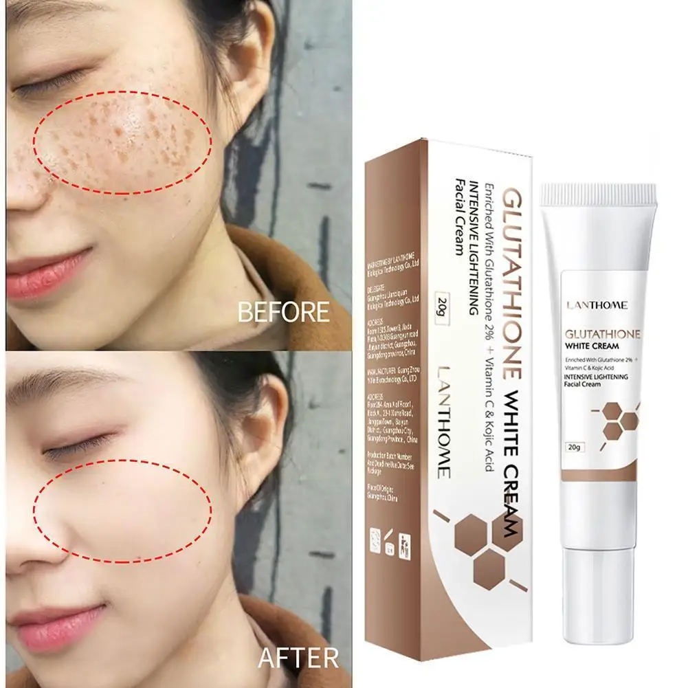 Glutathione Skin Whitening Cream Freckles Removal Spots Melanin Spot Dark Skin Moisturizing Lighten Care Cream Remo A7C2
Glutathione Skin Whitening Cream Freckles Removal Spots Melanin Spot Dark Skin Moisturizing Lighten Care Cream Remo A7C2