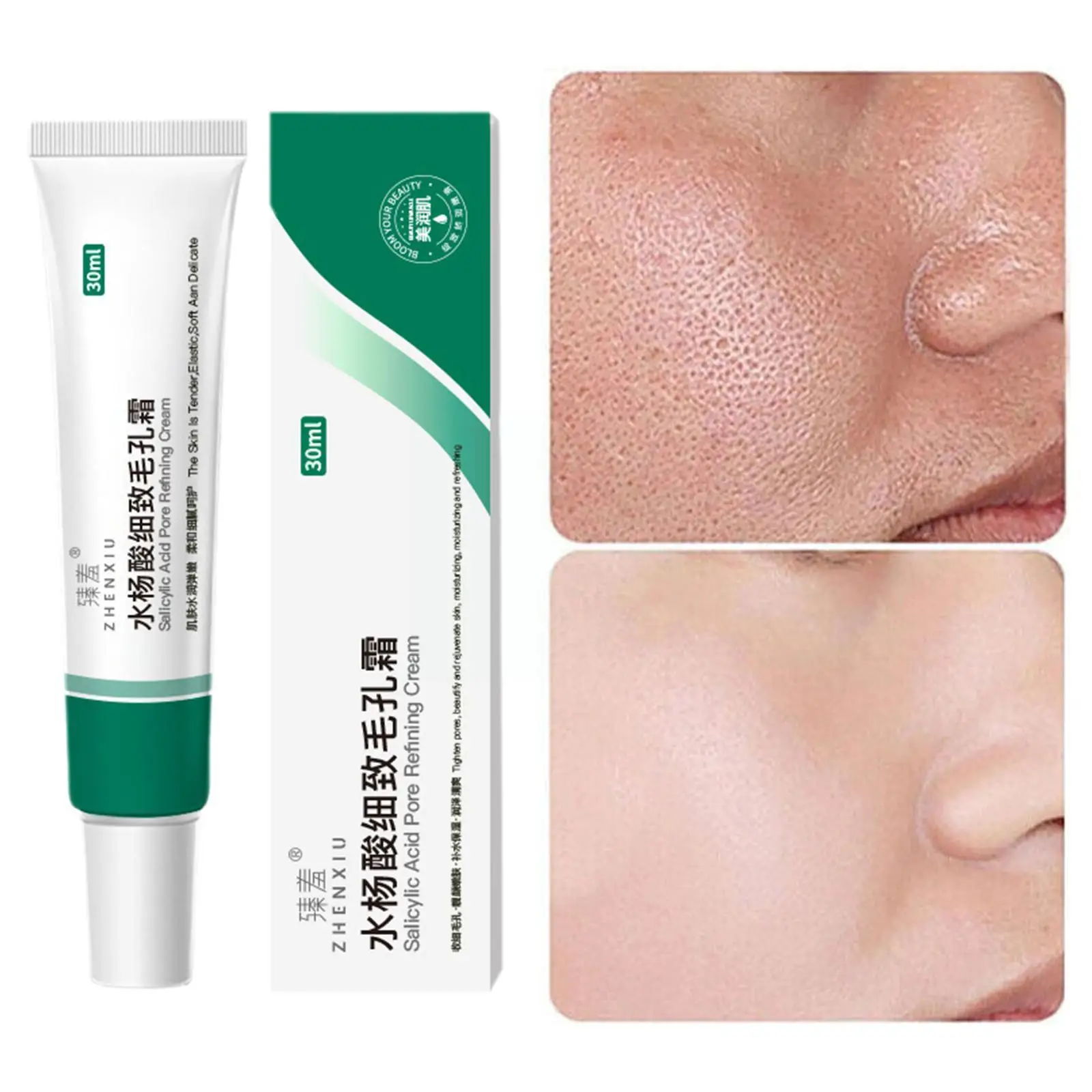 30ml Acne Cream Remove Blackhead Salicylic Acid Pores Refining Shrink Care Cream Improve Oily Skin Pore Moisturize H5A7
30ml Acne Cream Remove Blackhead Salicylic Acid Pores Refining Shrink Care Cream Improve Oily Skin Pore Moisturize H5A7