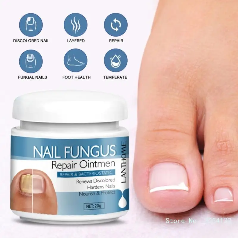 Уход за ногтями, сывороточный крем, антигрибковый гель для восстановления ногтей на ногах, антиинфекционный онихомикоз, паронихия, 20 г
Уход за ногтями, сывороточный крем, антигрибковый гель для восстановления ногтей на ногах, антиинфекционный онихомикоз, паронихия, 20 г