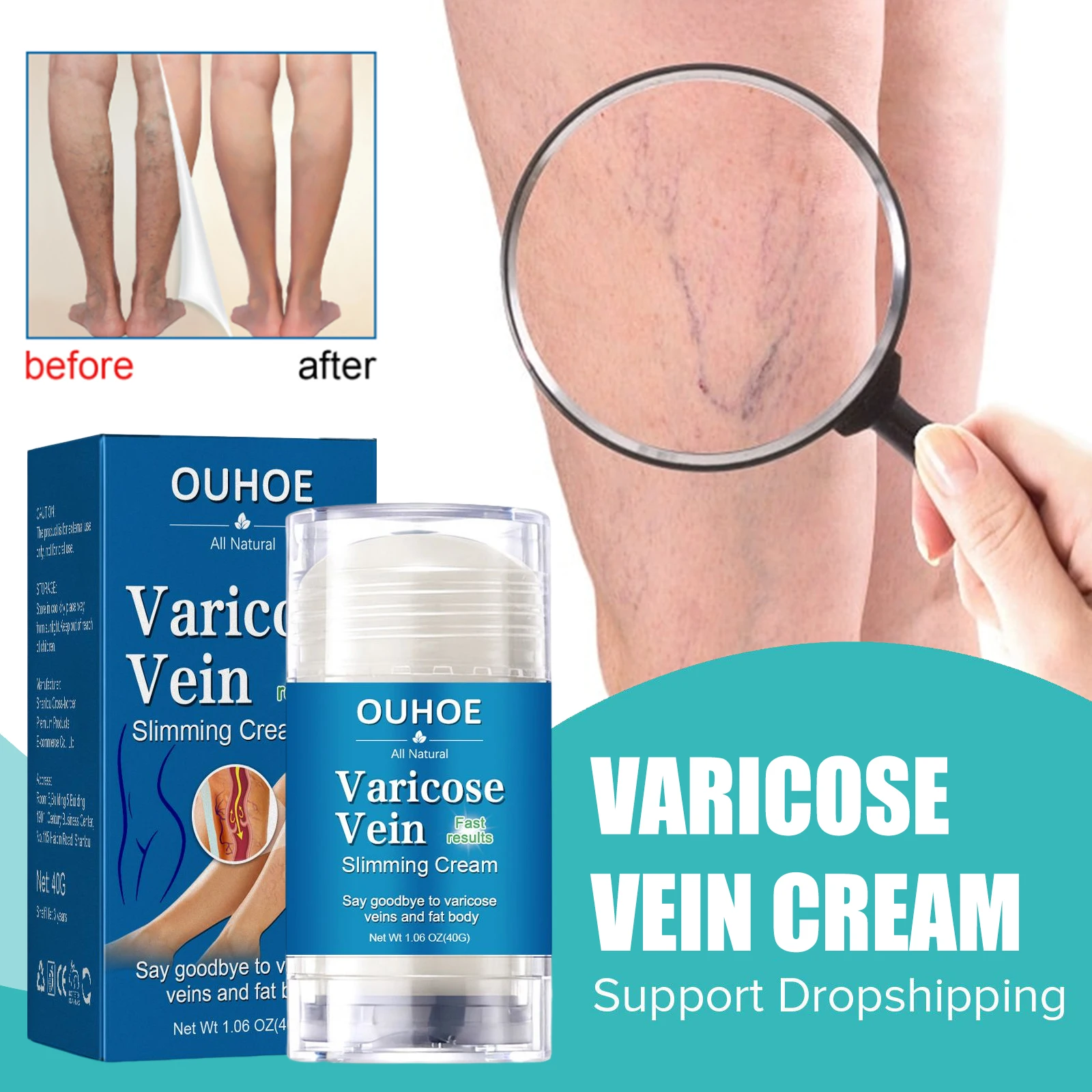 Portable Varicose Veins Relief Cream Relieve Legs Tired Vasculitis Phlebitis Improves Blood Circulation Spider Pain Ointment 40g
Portable Varicose Veins Relief Cream Relieve Legs Tired Vasculitis Phlebitis Improves Blood Circulation Spider Pain Ointment 40g