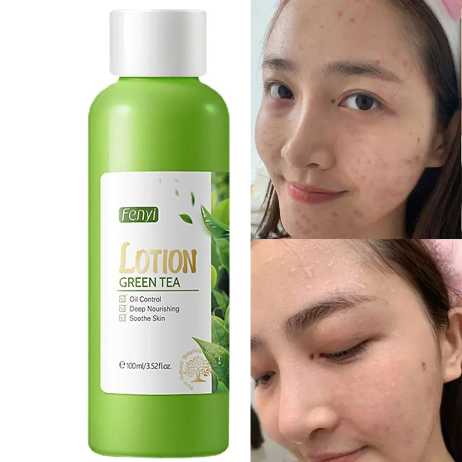 100ml Green Tea Face Lotion Oil-control Anti-Aging Shrink Pores Acne Treatment Whitening Moisturizing Tea Tree Essence Skin Care
100ml Green Tea Face Lotion Oil-control Anti-Aging Shrink Pores Acne Treatment Whitening Moisturizing Tea Tree Essence Skin Care