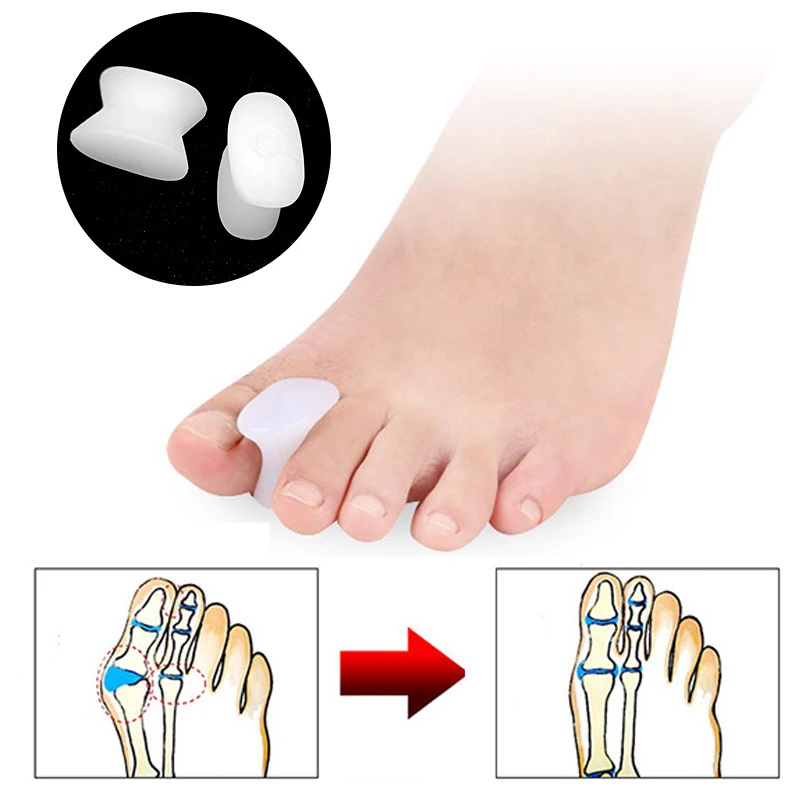 

Sdotter Silicone Gel Finger Toe Separator Correction Pad Orthopedic Toe Separators Hallux Valgus Bunion Guard Spint Foot Care To