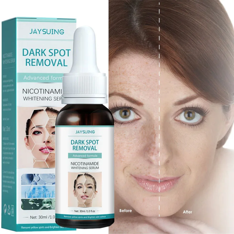 Nicotinamide Whitening Remove Freckle Face Serum Fade Dark Spots Melasma Melanin Pigmentation Brighten Beauty Korean Cosmetics
Nicotinamide Whitening Remove Freckle Face Serum Fade Dark Spots Melasma Melanin Pigmentation Brighten Beauty Korean Cosmetics
